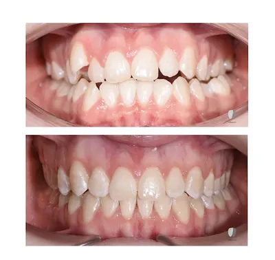 Ortodonta OrthoTeam Stomatologia Warmuz - Implanty zębowe